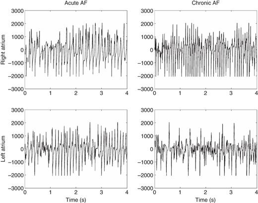 Left column: 4 s excerpts of raw epicardial electrogram signals from the right (top) and the left (bottom) atrium of an acute AF goat (from the ST group). Right column: 4 s excerpts of epicardial electrogram signals from the right (top) and the left (bottom) atrium of a chronic AF goat (from the LT group).