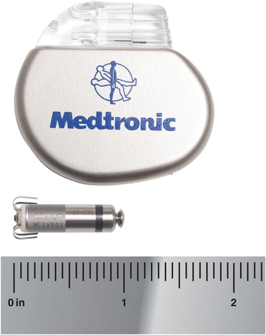 Miniaturized Micra technology: size of Micra compared with conventional pacemaker.
