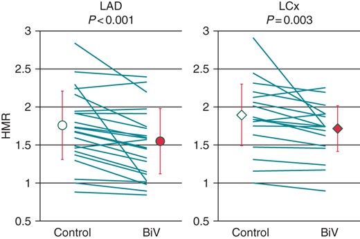 Effect of cardiac resynchronization therapy on hyperemic microvascular resistance in the left anterior descending coronary artery (LAD) and left circumflex coronary artery (LCx). Hyperemic microvascular resistance index (HMR) was significantly lower during biventricular pacing (BiV) than during Control (LAD, 1.76 ± 0.47 vs. 1.54 ± 0.45; P < 0.001; LCx, 1.92 ± 0.42 vs. 1.73 ± 0.31; P = 0.003).