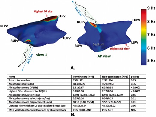 Figure 1A. An example of LA DF map during rotor presence; the trajectory of the rotor core was plotted on artificial fourth dimension representing time; the highest DF site was far away from the rotor site, but a next highest DF region was co-localised with rotor site. B. Table of features of ablated rotors in terminators and non-terminators, (mean ± std; square brackets for IQR; POS: posterior; ANT: anterior)