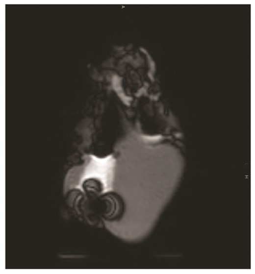 Abstract P437 Figure.