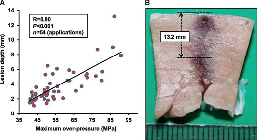 Relationship between SW intensity and lesion depth. (A) Shock wave intensity expressed as maximum overpressure significantly correlated with lesion depth (10 pigs, 54 applications, R = 0.80, P < 0.001). (B) Representative transmural lesion of the left ventricle with super-high intensity SW (75–90 MPa).