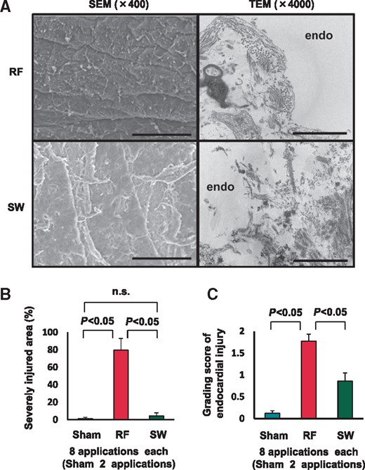 Endomyocardial injury by catheter ablation. (A) Radiofrequency lesion showed severe endomyocardial injury and destroyed endocardial basement membrane structure (upper panels), whereas SW lesion showed only mild denaturation with preserved membrane structure (lower panels). Scale bar; 100 μm (left panel, SEM) and 2 μm (right panel, TEM). SEM, scanning electron microscope; TEM, transmission electron microscope. (B and C) Shock wave catheter ablation caused markedly reduced myoendothelial injury compared with RFCA, in terms of severely injured area (left panel) and grading score of endocardial injury (right panel).