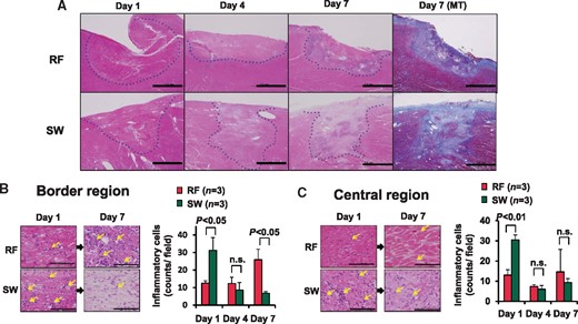 Time-course of formation and healing of ablated lesions. (A) In the RFCA lesion, necrotic lesions and heterogenous fibrotic lesions were noted at Day 7, respectively, whereas in the SWCA lesion, healing process was accelerated with homogenous fibrotic lesions at Day 7. Dashed line denotes the ablated lesion. Scale bars, 2 mm. (B) In the border region, RF lesions had only a few inflammatory cells at Day 1, which was later increased at Day 7, whereas the SW lesions had enhanced infiltration of inflammatory cells at Day 1 followed by rapid decrease at Day 7. (C) In the central regions, the SW lesions had a higher number of inflammatory cells at Day 1 compared with RFCA lesions (left panel, HE). Scale bars, 200 μm. HE, haematoxylin–eosin staining.