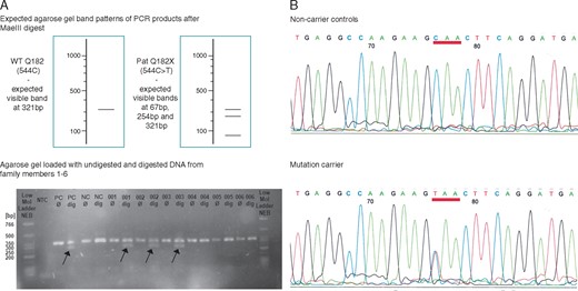 Genetic analysis in LMNA exon 3 (A) The upper image shows the expected agarose gel band patterns after digestion of PCR products with restriction enzyme MaeIII. The lower image is a representative agarose gel with non-digested (Ø) and digested (dig) samples from patients and non-carrier controls. After digestion, one band was seen in non-carriers, while two bands were seen in mutation-carriers due to the small size of the 3rd band. (B) Sequencing results of the PCR product in non-carrier control (upper panel) and mutation-carrier (lower panel). Different bases are indicated by letters and colour-coded. NC, negative control; NTC, no template control; PC, positive control; PCR, polymerase chain reaction; WT, wild type.