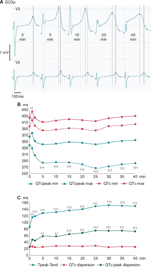 Changes of basic ECG parameters of ventricular repolarization during coronary occlusion. (A) The representative QRST complexes in the leads with maximal (V3) and minimal, if any (V5), ST-segment displacement during the course of LAD occlusion. Automatically measured margins of QRS complexes and markers for the Tpeak and Tend are indicated by the short vertical lines and circles, respectively. Note the increased dispersion of Tpeak timing (long vertical lines) due to QTpeak shortening in V3. (B) The time course of repolarization duration indices (averaged durations of maximal and minimal QTc and QTcpeak intervals). (C) The time course of repolarization heterogeneity indices (averaged values of Tpeak-Tend interval, QTc dispersion and QTcpeak dispersion) ††P < 0.01 vs. baseline; †††P < 0.001 vs. baseline. LAD, left anterior descending coronary artery.
