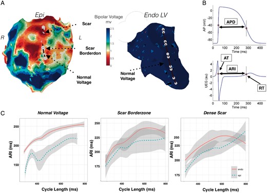 Restitution studies in a patient with previous myocarditis and predominant epicardial scar (Patient 1). (A) Endocardial and epicardial bipolar voltage maps highlighting a large region of anterior epicardial scar. Position of catheters simultaneously placed endocardially and epicardially for transmural recording is shown. (B) The Wyatt method was used to analyse RT. AT measured as dV/dtmin of the QRS and RT as the dV/dtmax of the unipolar intracardiac electrogram T-wave. ARI (ARI = RT − AT), was measured as a surrogate marker of APD. (C) ARI restitution during endocardial pacing, across epicardial normal voltage tissue, epicardial scar borderzone, and epicardial dense scar. APD, action potential duration; ARI, activation recovery interval; AT, activation time; Endo, endocardium; Epi, epicardium; NS, non-significant; RT, repolarization time.