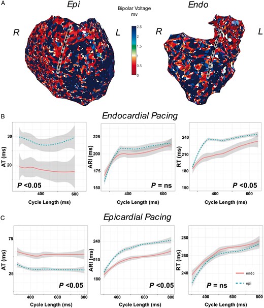 (A) Restitution studies in a patient with ARVC across a region of transmural scar in the RVOT (Patient 6). Catheters are positioned transmurally in the anterior RVOT during restitution studies while pacing (B) the Endo and (C) Epi. ARI, activation recovery interval; ARVC, arrhythmogenic right ventricular cardiomyopathy; AT, activation time; Endo, endocardium; Epi, epicardium; NS, non-significant; RT, repolarization time; RVOT, right ventricular outflow tract.