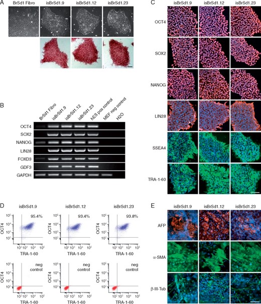 (A) The generated iPSC lines isBrSd1.9, isBrSd1.12, and isBrSd1.23 generated from skin fibroblasts of the BrS patient display a typical morphology for human pluripotent stem cells (upper panel) and are positive for alkaline phosphatase (lower panel). (B) In comparison to donor’s fibroblasts, generated iPSC lines show expression of endogenous pluripotency markers OCT4, SOX2, NANOG, LIN28, FOXD3, and GDF3 at mRNA level proven by RT-PCR. hESCs were used as positive control, MEFs were used as negative control. (C) Generated iPSC lines express pluripotency markers OCT4, SOX2, NANOG, LIN28, SSEA4, and TRA-1-60 as shown by immunofluorescence staining. Nuclei are co-stained with DAPI. Scale bar: 100 µm. (D) Flow cytometry analysis of pluripotency markers OCT4 and TRA-1-60 reveals a homogeneous population of pluripotent cells in generated iPSC lines. (E) Spontaneous differentiation potential of generated iPSC lines was analysed by embryoid body (EB) formation. Immunocytochemical staining of spontaneously differentiated iPSC lines shows expression of endodermal marker AFP, mesodermal-specific α-SMA, and ectodermal βIII-tubulin. Nuclei are co-stained with DAPI. Scale bar: 100 µm. BrS, Brugada syndrome; hESCs, human embryonic stem cells; iPSC, induced pluripotent stem cell; MEFs, mouse embryonic fibroblasts.