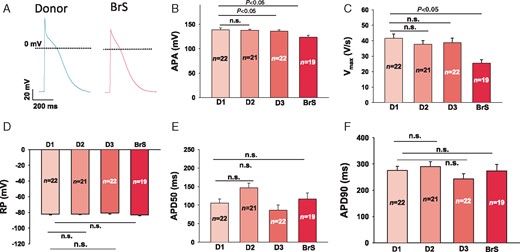 Changes of action potential in hiPSC-CMs from the BrS patient. APs were evoked by pulses of 1 nA for 3 ms at 1 Hz in current clamp mode. When APs reached steady state, 10 sequential APs were recorded and mean values were calculated for each cell. The AP parameters were analysed by computer using an ISO-3 multitasking patch-clamp programme (MFK M. Friedrich, Niedernhausen, Germany). (A) Representative traces of APs in donor (D1, D2, and D3) and BrS cells. (B) Mean values of APA. (C) Mean values of maximal depolarization velocity (Vmax) of APs. (D) Mean values of RPs. (E) Mean values of AP duration at 50% repolarization (APD50). (F) Mean values of AP duration at 90% repolarization (APD90). AP, action potential; APA, action potential amplitude; BrS, Brugada syndrome; hiPSC-CMs, human-induced pluripotent stem cell-derived cardiomyocytes; n, number of cell; n.s., not statistically significant; RP, resting potential.
