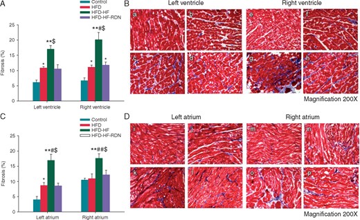 Ventricular and atrial tissue fibrosis among all groups. (A) Quantitative analysis of fibrotic area in the ventricle. (B) The example of Masson’s trichrome staining: (a) control rabbits left ventricle; (b) HFD rabbits left ventricle; (c) HFD-HF rabbits left ventricle; (d) HFD-HF-RDN rabbits left ventricle; (e) control rabbits right ventricle; (f) HFD rabbits right ventricle; (g) HFD-HF rabbits right ventricle; and (h) HFD-HF-RDN rabbits right ventricle. (C) Quantitative analysis of fibrotic area in the atrium. (D) The example of Masson’s trichrome staining: (i) control rabbits left atrium; (j) HFD rabbits left atrium; (k) HFD-HF rabbits left atrium; (l) HFD-HF-RDN rabbits left atrium; (m) control rabbits right atrium; (n) HFD rabbits right atrium; (o) HFD-HF rabbits right atrium; and (p) HFD-HF-RDN rabbits right atrium. HF, heart failure; HFD, high-fat diet; RDN, renal denervation. *P<0.05 vs. Control, **P<0.01 vs. Control, #P < 0.05 vs. HFD, ##P < 0.01 vs. HFD and $P < 0.05 vs. HFD-HF-RDN.