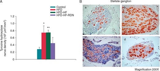 Sympathetic nerve activities in the left stellate ganglion. (A) Sympathetic neuron marker densities among all groups. (B) The example of TH staining: (a) control rabbits stellate ganglion; (b) HFD rabbits stellate ganglion; (c) HFD-HF rabbits stellate ganglion; and (d) HFD-HF-RDN rabbits stellate ganglion. HF, heart failure; HFD, high-fat diet; RDN, renal denervation. *P<0.05 vs. Control and **P<0.01 vs. Control.