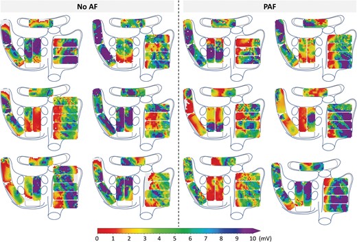 Representative examples of unipolar epicardial voltage maps during one sinus beat in six patients without history of AF (left) and six patients with PAF (right). (P)AF, (paroxysmal) atrial fibrillation.