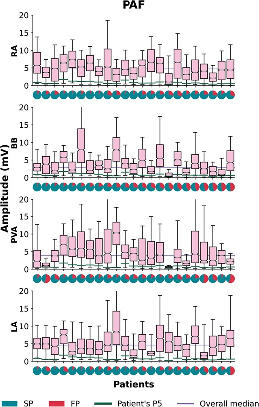 Boxplots of the voltage distributions during SR depicted for each patient separately with PAF recorded at the RA, BB, PVA, and LA. For each patient a pie plot of the potential type distribution is given, indicating the number of SPs (turquoise) and FPs (red). For each patient, a green line indicates a patient’s voltage p5 and the lilac line represents the overall voltage median per atrial region. Patients are ranked in descending order according to the amount of single potentials at BB. BB, Bachmann’s bundle; FP, fractionated potentials; LA, left atrium; PAF, paroxysmal atrial fibrillation; PVA, pulmonary vein area; RA, right atrium; SP, single potentials; SR, sinus rhythm.