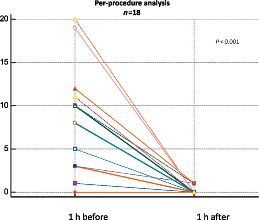 Per-procedure analysis (n = 18) showing the overall number of arrhythmic events in the hour after each PLSGB compared with the hour before.