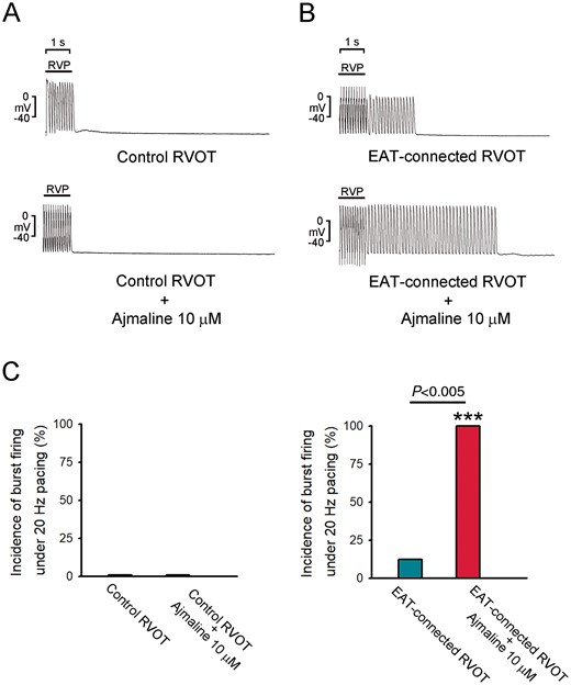 Effects of VA inducibility in EAT-connected and control RVOTs. (A) Examples of burst pacing alone in EAT-connected and control RVOTs. (B) Examples of burst pacing plus ajmaline (10 μM) superfusion in EAT-connected (N = 8) and control RVOTs (N = 6). (C) Average data of VA induction in different RVOT preparations. ***P < 0.005 (vs. control RVOTs plus ajmaline 10 μM). EAT, epicardial adipose tissue; RVOT, right ventricular outflow tract; VA, ventricular arrhythmia.