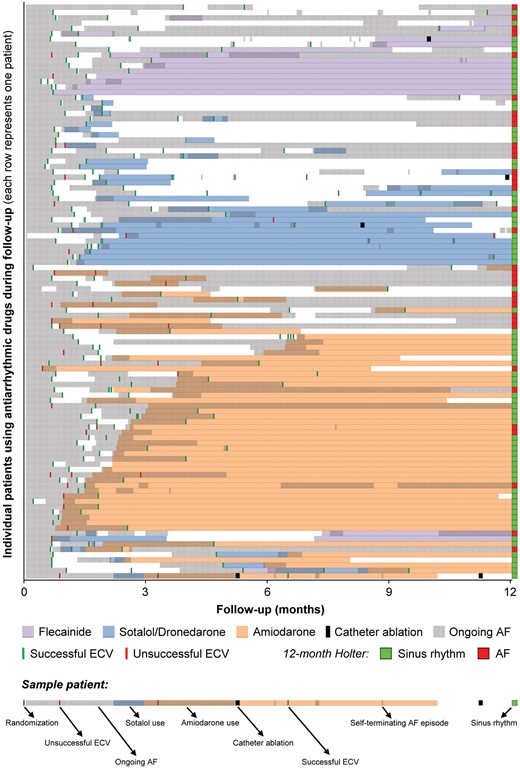 Timeline of events in patients using antiarrhythmic drugs (each row represents the timeline of one patient with all events related to rhythm control of that patient marked on the timeline). AF, atrial fibrillation; ECV, electrical cardioversion.