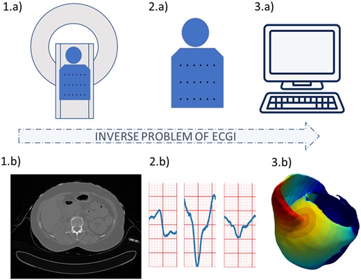 Electrocardiographic imaging process. Using (A) cardiac imaging and (B) signal processing, we obtain information on (D) the cardiac geometry and the position of the electrodes used to record the ECG signals, and (E) the surface ECG signals. Both are then used by (C) numerical methods to reconstruct the (F) cardiac electrical activity.