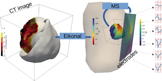Synthetic data simulation process: myocardial wall thickness from patient image is used to parameterize the Eikonal model that generates activation maps (LAT, local activation time). The Mitchell–Schaeffer model with the dipole formulation are used to generate BSP mapping signals. BSP, body surface potentials.