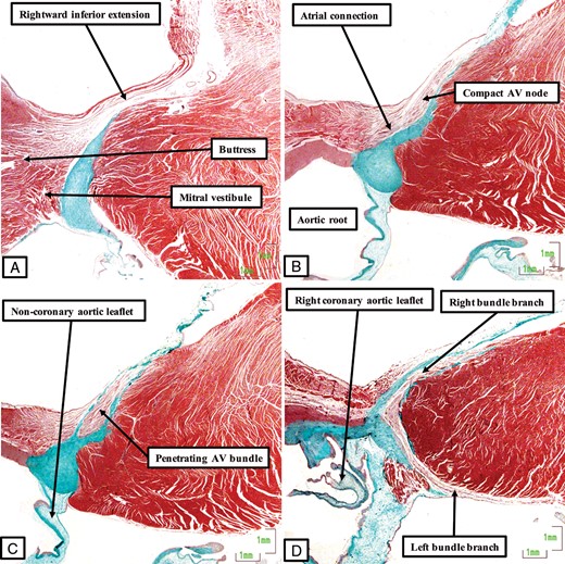 The images, prepared from a histological dataset in the same fashion as for the other species, show the arrangement of the conduction axis in the porcine heart. (A) The inferior extension of the atrioventricular node in the vestibule of the tricuspid valve. It has connections with the atrial myocardium and the level of attachment of the right fibrous trigone to the septum, but minimal input from the myocardium of the mitral vestibule (B). Having penetrated through the area of fibrous continuity between the leaflets of the mitral and tricuspid valves (C), the axis runs a long non-branching course on the right side of the ventricular septum before branching in the region of the interleaflet triangle between the non-coronary and right coronary leaflets of the aortic valve. The left bundle branch is directly adjacent to the hinge of the right coronary leaflet (D).