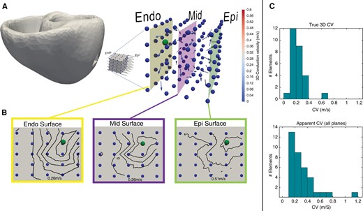 (A) Intramural needle electrodes demonstrating 3D CV (arrow vectors) from pacing source (ball). (B) 2D CV has been determined for each surface: endocardium, mid-myocardium, and epicardium. Note the approximately two-fold increase in CV on the epicardium. (C) Shows 3D and 2D CVs. CV, conduction velocity 2D, two-dimensional; 3D, three-dimensional.