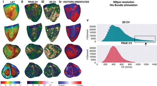 Five-hundred micrometre resolution, sinus activation. Global epicardial and endocardial LAT maps (i), CV vector maps for 3D (ii) and 2D CV (iii), CV vector surface orientation (iv), and CV histograms (v). CV, conduction velocity; LAT, Local activation time; 2D, two-dimensional; 3D, three-dimensional.
