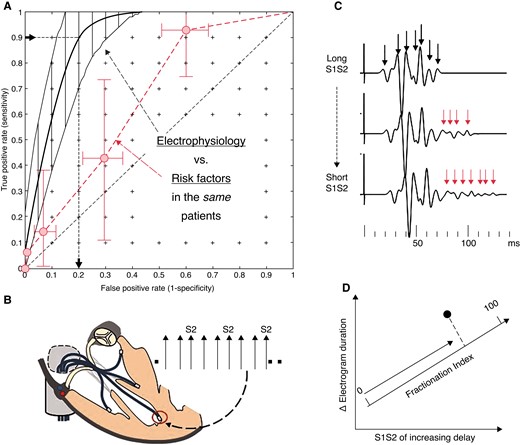 (A) The mean ROC and bootstrapped limits for electrophysiological method (black), which is a continuous variable and so can be plotted as a curve. The non-electrophysiological (RF) method (red) is measured in the same patients and plotted as number of RFs and the limits obtained by integration of the 2D bootstrap. Data from Saumarez et al.17 The false positive rate for 90% of event detection for EP is shown. (B) Electrodes are placed at four sites in the right ventricle (apex, mid-septum, RVOT, and free wall). Each site is paced in turn with a decremental sequence with an S2 inserted every third beat. The pacing sequence is repeated at each site with recordings made from the remaining electrodes. (C) The electrograms are processed to identify each potential, and in high-risk patients, the electrograms become prolonged with multiple delayed potentials as the S1S2 interval is decreased (arrowed). These are quantified by determining the S1S2 at which electrogram delay increases and the overall increase in electrogram duration. (D) These are averaged for all the runs to yield a single observation, which is projected on a ‘fractionation axis’ (formed prospectively by the principal component of the data from the initial studies).