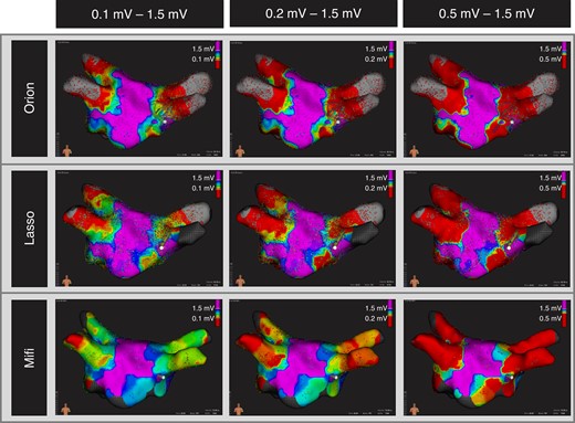 Representative bipolar voltage amplitude maps for the Orion catheter (top row), the Lasso catheter (middle row), and Mifi catheter (bottom row) for the three established cutoffs 0.1–1.5 mV, 0.2–1.5 mV, and 0.5–1.5 mV. The scar area in red decreases from the Orion over the Lasso to the Mifi catheter for every scar cutoff (0.1 mV, 0.2 mV, 0.5 mV).