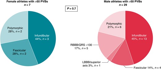 Prevalent morphologies of ventricular arrhythmias among female and male athletes with >50 isolated PVBs. LBBB, left bundle branch block; PVBs, premature ventricular beats; RBBB, right bundle branch block.