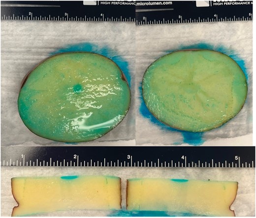 Lesion obtained at 0.5 mm (left panel and lower panel) and at 1 mm (right panel) catheter-specimen distance.
