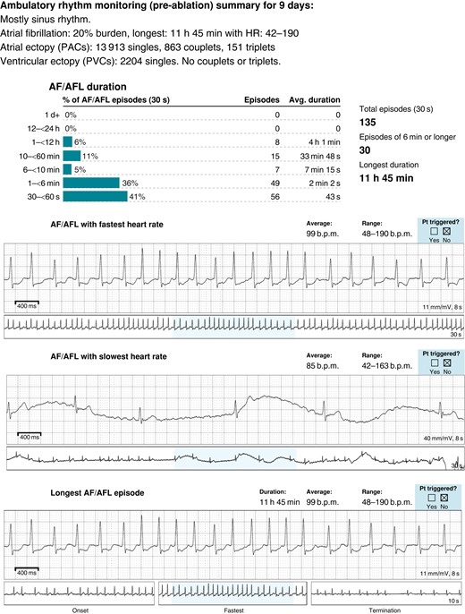 Ambulatory monitoring showing AF in Patient 1 with KS.