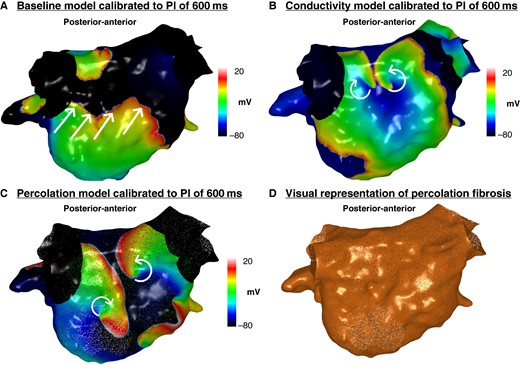 Simulated propagation patterns as transmembrane potential map in a posterior–anterior view generated from the (A) baseline personalized model calibrated to a PI of 600 ms, (B) conductivity model calibrated to a PI of 600 ms, and (C) percolation model calibrated to a PI of 600 ms. The straight lines indicate the propagation direction of a non-rotational wavefront. The curved arrows indicate a rotational wavefront propagation. Both conductivity and percolation models demonstrate rotational activity on the posterior wall, whilst this was not seen on the baseline model. (D) Visual representation of percolation fibrosis. PI, pacing interval.