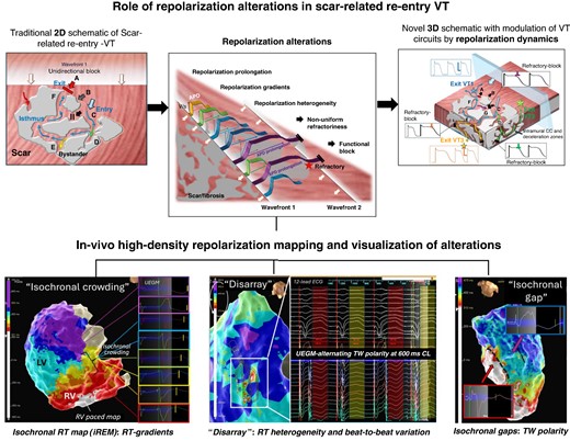 Role of repolarization alterations in scar-related re-entry and assessment by electro-anatomical mapping.