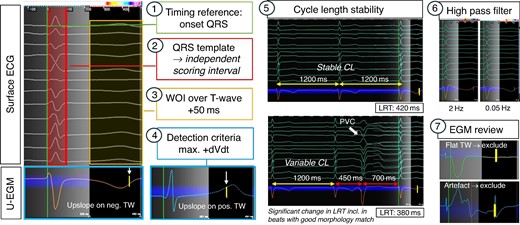 How to set-up repolarization maps. Setting up a repolarization map follows the same principles as for activation mapping, yet notable differences are in placing the WOI over the T wave, using the max. +dVdt as detection criteria and adjusting the high-pass filter to 005 Hz. Importantly, there are no automated feature to recognize distorted or flat TW, and therefore, careful manual review is required to exclude EGMs where no reliable LRT annotation is feasible (examples here: flat TW and artefact in TW). CL, cycle length.
