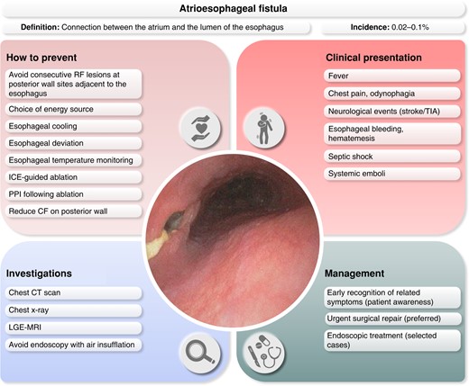 Prevention, clinical presentation investigation, and management of atrio-oesophageal fistula. CF, contact force; CT, computed tomography; ICE, intracardiac echocardiography; LGE, late gadoliniun enhancement; MRI, magnetic resonance imaging; PPI, proton pump inhibitor; RF, radiofrequency; TIA, transient ischemic attack.