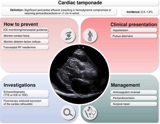 Prevention, clinical presentation, investigation, and management of periprocedural cardiac tamponade. ICE, intracardiac echocardiography; RF, radiofrequency; TEE, transesophageal echocardiography; TTE, transthoracic echocardiography.