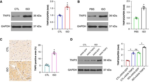 TNIP3 was up-regulated in ISO-induced cardiomyocytes. (A) Representative western blot and statistical results of TNIP3 protein expression in vivo (n = 4). (B) Representative western blot and statistical results of TNIP3 protein expression in vitro (n = 4). (C) Immunohistochemical staining of TNIP3 in heart tissues from control and ISO mice (n = 5). (D) Representative western blot and statistical results of TNIP3 protein expression following TNIP3 overexpression in vivo (n = 4). *P < 0.05. ISO, isoproterenol; TNIP3, tumour necrosis factor alpha-induced protein 3-interacting protein 3.
