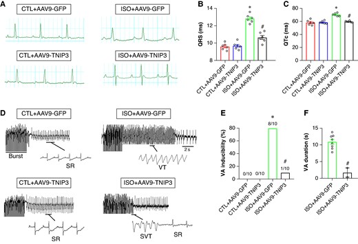 TNIP3 overexpression diminished ventricular arrhythmia susceptibility in ISO-induced heart failure mice. (A) Representative electrocardiogram images. (B–C) Quantitative of QRS interval and QTc (n = 6 per group). (D) Representative examples of VA induced by burst-stimulating. (E) Ratio of burst-induced VAs and (F) duration of VA (n = 10 per group). *P < 0.05 vs. CTL + AAV9-GFP group. #P < 0.05 vs. ISO + AAV9-GFP group. SR, sinus rhythm; VA, ventricular arrhythmia.