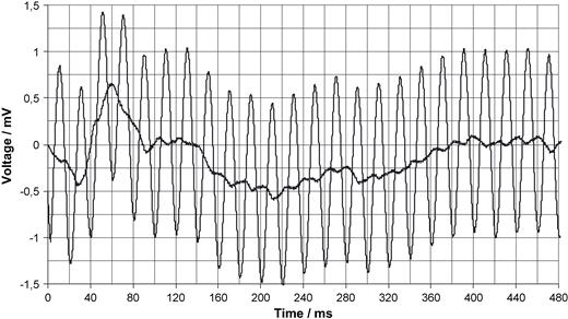 Derivation of an ECG from the thorax with (bold line) and without filtering in the noisy environment of a MRI unit (without scanning) as described in Fig. 3 . The voltage is referred to the input.