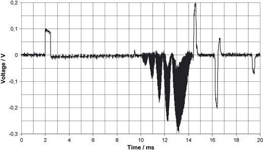 Beginning of the scan with expanded time deviation. Signals produced by RF pulses before gradient pulses are visible.