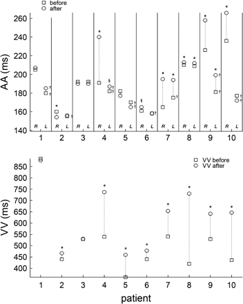 Top panel shows 〈AAr〉 ?> and 〈AAl〉 ?> during AF before and after the administration of medication in all the patients. *P < 0.001, §P < 0.05 after vs before medication; †P < 0.001 LA vs RA. Bottom panel shows the VV interval 〈VV〉 ?> in all patients before and after medication. See text for comments.