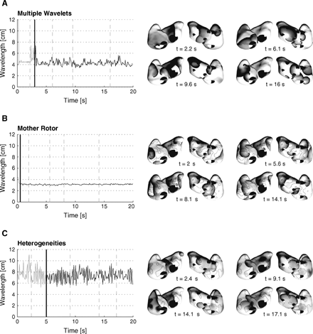 Wavelength during AF initiation and perpetuation estimated using the direct method for the substrate A, B and C. The thick vertical lines indicate the end of the initiation protocol. The right panels display transmembrane potential maps, grey-level coded from white (resting potential) to black (excited tissue). Thick black lines represent propagating wave fronts. For each space plot, an anterior view (on the left) and a posterior view (on the right) are shown.