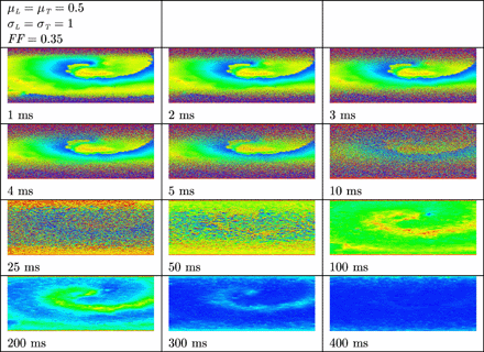 Termination of a spiral wave in remodelled tissue by means of defibrillation. The anode was a line electrode at the top and the cathode a line electrode at the bottom of the tissue. A uniform electric field was applied during 10 ms. Shown are the membrane potentials for different simulation times during and after field stimulation. Depolarized tissue is coloured light and repolarized or hyperpolarized tissue dark.