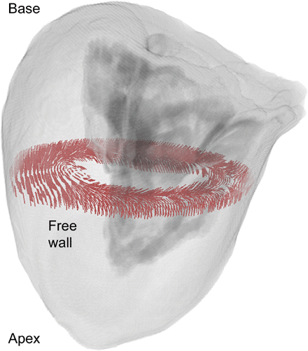 Three-dimensional anatomical model of the human left ventricle obtained from the Visible Female data set in transparent view. An exemplary cross-sectional slice perpendicular to the longitudinal axis depicts the realistic rotating fibre orientation within the wall.