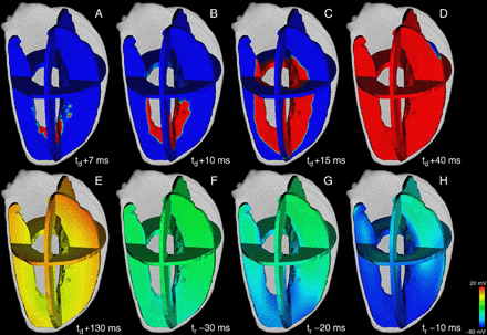 Activation and repolarizing phase in short QT mutant case in the same anatomical and excitation propagation model and at the same relative time steps as in Fig. 7. The mutation had no effect on the activation of the virtual ventricle but led to a marked abbreviation of the repolarization time. Time to full repolarization was decreased to tr = 253 ms. Final repolarization was homogenized in the transmural direction caused by the reduced dispersion of repolarization within the wall.