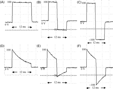 Waveforms tested during the investigation. Waveforms B and C are examples of those tested during experiment 1. The RF defibrillator generated waveforms A–C during experiment 2. Waveform A, rectangular monophasic waveform; waveform B, asymmetric rectangular biphasic waveform (phase-2 peak voltage reduced to 50% of phase-1); waveform C, symmetrical rectangular biphasic waveform (phase-2 peak voltage=phase-1). Waveforms D–F were generated by the Ventritex HVS-02. Waveform D, conventional monophasic waveform; waveform E, conventional asymmetric biphasic waveform (phase-2 peak voltage reduced to 50% of phase-1; equivalent time constant for both phases); waveform F, conventional symmetrical biphasic waveform (phase-2 peak voltage=phase-1).