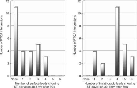 Comparison of the number of surface and IT-ECG leads showing significant ST-segment deviation (≥0.1 mV) after 30 s of coronary occlusion.