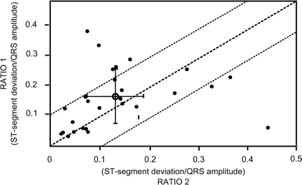 Comparison of the ST-segment deviation amplitude/QRS amplitude ratio using the IT-ECG leads (RATIO 1) and the conventional surface ECG leads (RATIO 2). All 27 PTCA attempts are included, the mean value of RATIO 1/RATIO 2 is marked with its standard deviation showing a moderate linear relationship despite an overall double QRS and ST-segment amplitude in the IT-ECG leads.