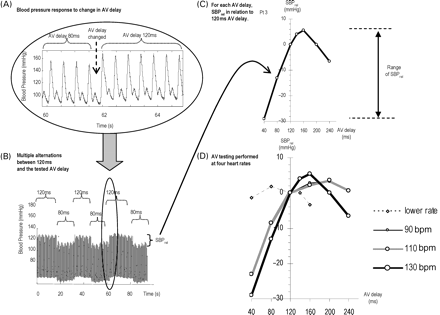Effect of altering AV delay on blood pressure. (A) Example of the prompt change in blood pressure when the AV delay is changed. (B) A longer segment of the same recording, which includes several alternations of AV delay (in this example between 80 ms and the reference value of 120 ms) giving several replicate measures of SBPrel (systolic blood pressure relative to systolic blood pressure at the reference AV delay of 120 ms). (C) How SBPrel varies as AV delay is varied from 40 to 240 ms. (D) This relationship for four different heart rates (with SBPrel at each heart rate measured against the reference AV delay of 120 ms at that heart rate).