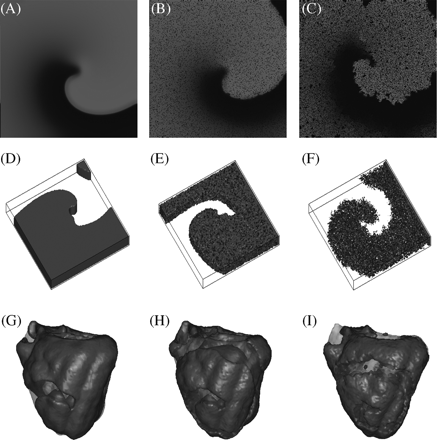 Stable spiral wave rotation in 2D tissue sheets with (A) 0, (B) 10, and (C) 30% fibrosis. Spiral rotation in 3D tissue slabs with (D) 0, (E) 30, and (F) 60% fibrosis, and in the human ventricular geometry with (G) 0, (H) 30, and (I) 50% fibrosis.